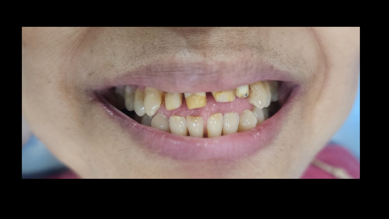 6A